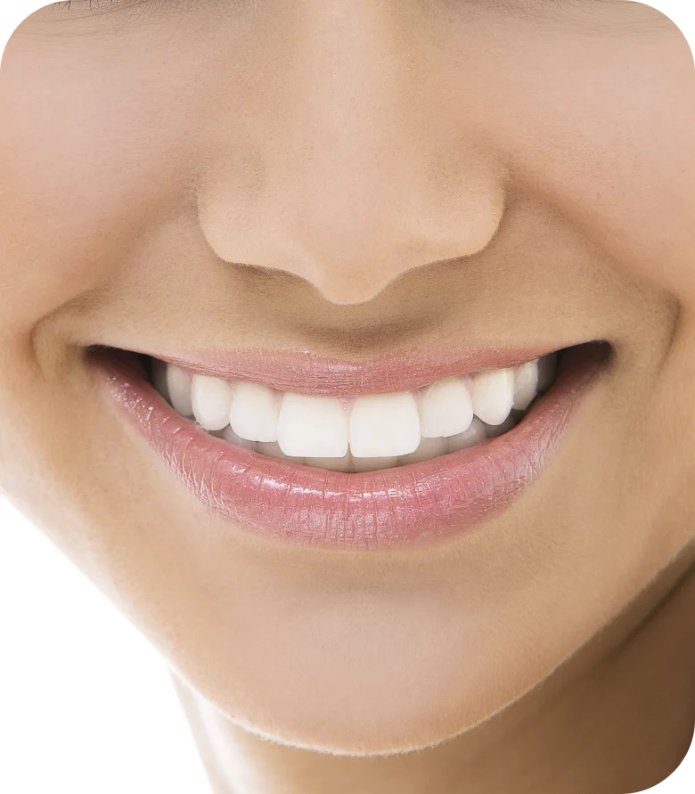 After Treatment