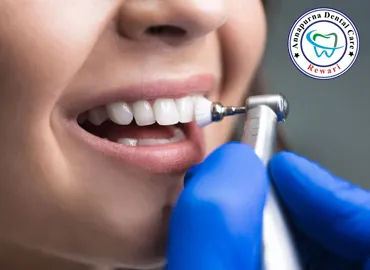 Teeth Cleaning